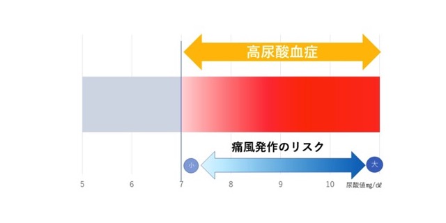 痛風発作のリスク