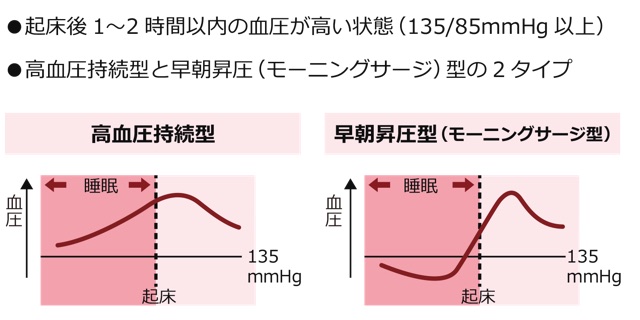 早朝高血圧