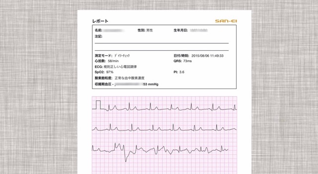 チェックミー